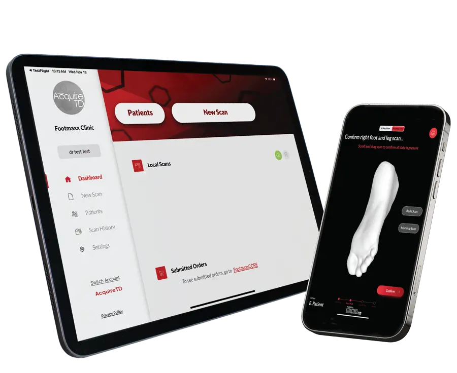 Footmaxx AcquireTD 3D structural foot scanning on iPad