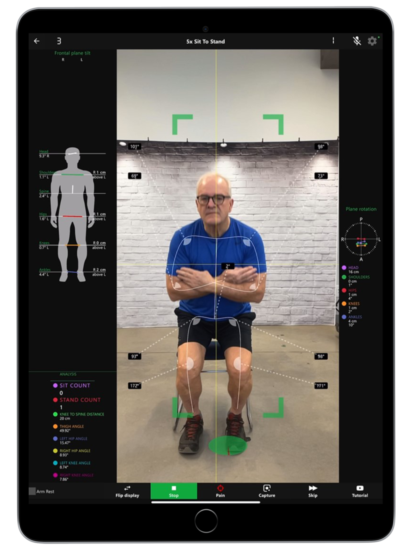 Live Kinetisense clinical assessment — real patient being analyzed in the Kinetisense software in real time